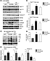 Improved Akt phosphorylation in livers of HFD-fed ChREBP mice.