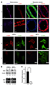 JunbΔ/– arteries and cells show severely diminished levels of Myl9 protein