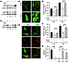 Reexpression of Junb or Myl9 in Junb–/– cells restores stress fiber formati