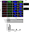 Detection of nuclear pro–IL-16 protein by confocal microscopy and Western b