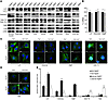 Analysis of Lc3, Gabarap, Gate-16, Atg8l, and Lc3a status in WT and Atg4b–/