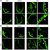 The correct localization of otoconial core proteins is dependent on autopha