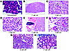 Tg-rtTA/tetO-BRAFV600E mice develop thyroid cancer that regresses upon dox