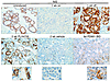 Nis protein expression and localization are restored upon dox withdrawal or