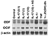 Expression of ODF mRNA by IL-17. A blot loaded with 20 μg of total RNA from