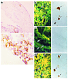 Immunohistochemical staining for IL-17, CD4, CD8, and CD45RO in the synovia