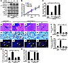 Dock180 mediates PDGFRα-stimulated glioma cell survival in vitro, tumor gro