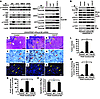 p-Y of Dock180Y1811 is required for PDGFRα-promoted glioma growth and invas