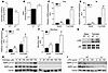 AMPK β1 buffers against lipid accumulation and palmitate-induced macrophage