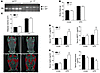 Hematopoietic deletion of AMPK β1 results in systemic inflammation despite