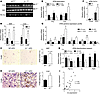 Hematopoietic deletion of AMPK β1 results in macrophage recruitment and inf