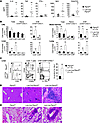 Inflammation and lymphocytic infiltrates in Lck-Cre;Ptpn2fl/fl mice.