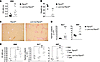 ANAs and organ damage in Lck-Cre;Ptpn2fl/fl mice.