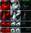 Localization of TMC2::AcGFP.