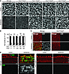 Tmc1Δ and Tmc2Δ hair cell uptake of gentamicin.