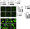 The AKAP WAVE1 mediates OxPL inhibition of phagocytosis in peritoneal macro