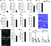 Thyroid phenotype in astro-D2 KO mice versus GFAP-cre controls.