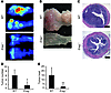 Colitis-associated tumorigenesis in Ereg-deficient mice.