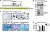 Expression profiles of ETP.