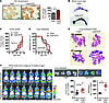 ETP augments primary tumor growth and pulmonary metastasis in the backgroun