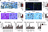 Histological analysis for tumor tissues of PyMT/ETP versus PyMT mice.