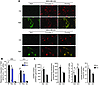 Enhancement of mitochondrial complex I activity by integration of Ndi1: met