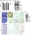 Mitochondrial complex I activity regulates mTORC1 and autophagy.