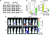 Metastasis inhibition by enhanced complex I activity depends on autophagy.