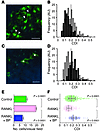 Visualization of mature osteoclasts under pathophysiological conditions.