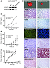 Requirement of autocrine VEGF/VEGFR2 signaling for induction of angiogenesi