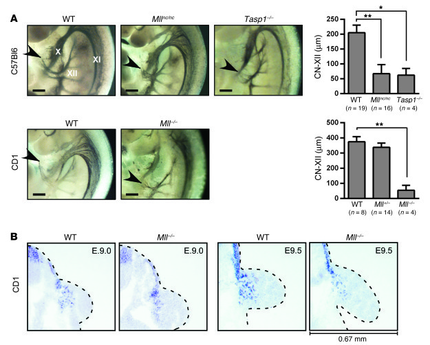 
Mll–/– mice exhibit CNXII outgrowth and myoblast migration defects.
 
(...