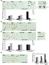 Suppression of Pol II phosphorylation by E. coli 83972