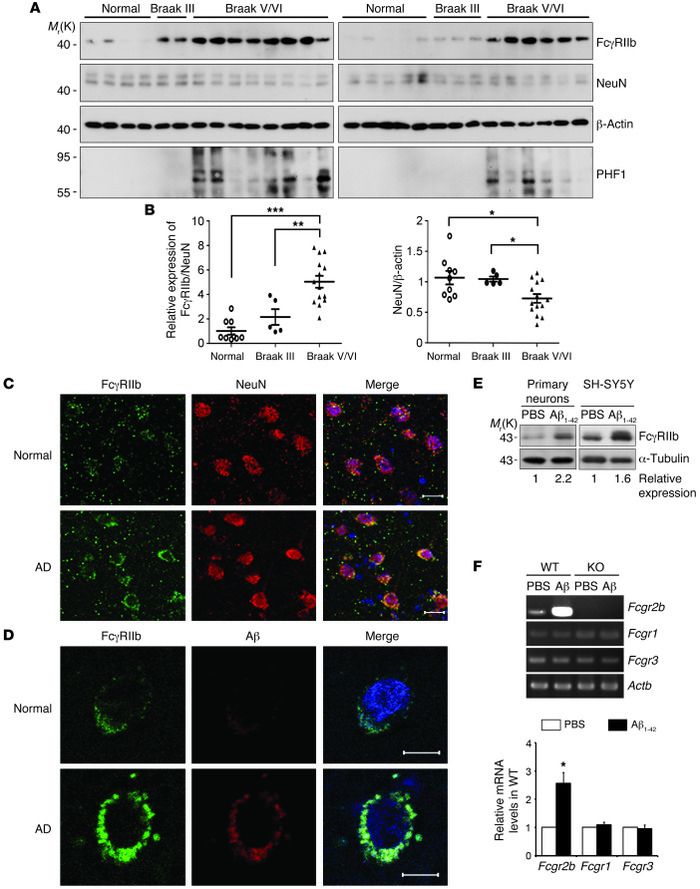 Increased expression of FcγRIIb in the neurons of AD brains.
(A) Increas...