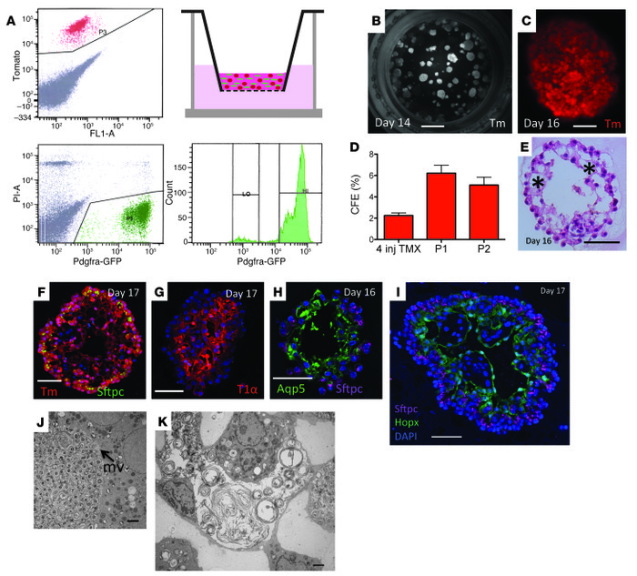 Self renewal and differentiation of AEC2 cells in 3D organoid culture.
(...