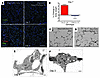 Injury/repair model using Rosa-DTA to selectively kill AEC2s in the adult l