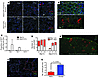 SFTPC+ cells proliferate clonally after targeted AEC2 depletion.