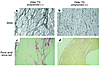 Morphological analysis in the myocardium of 16-month-old Gsα TG mice treate