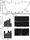 Vincristine treatment induces mechanical allodynia and macrophage infiltrat