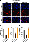 Intranasal prophylaxis with SAH-RSVFBD inhibits spread of RSV infection to