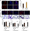 Intratracheal SAH-RSVFBD as a NP preparation inhibits pulmonary RSV infecti