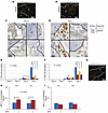 Effect of the SDF-1/CXCR4 axis on LNM.