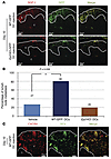 COX-2–derived PGE2-EP3 signaling induces LNM and lymphangiogen