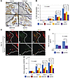 COX-2–derived PGE2-EP3 signaling induces LNM by facilitating t