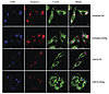 Manipulation of the actin cytoskeleton reverses actin changes caused by des