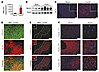 MLKL is strongly upregulated in hepatocytes in experimentally induced hepat