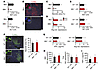 MLKL expression in hepatocytes drives ConA-induced necrotic cell death.