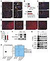 RIPK3 is dispensable for ConA-induced hepatic injury.