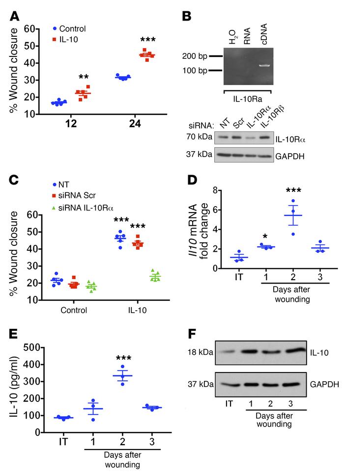 IL-10 is synthesized and released as a response to intestinal mucosal in...