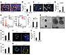 Increased alveolar epithelial type II (AT2) cell proliferation in Cldn18–/–