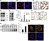 Activation of YAP signaling in whole lung and alveolar epithelial type II (